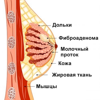 Фиброаденома